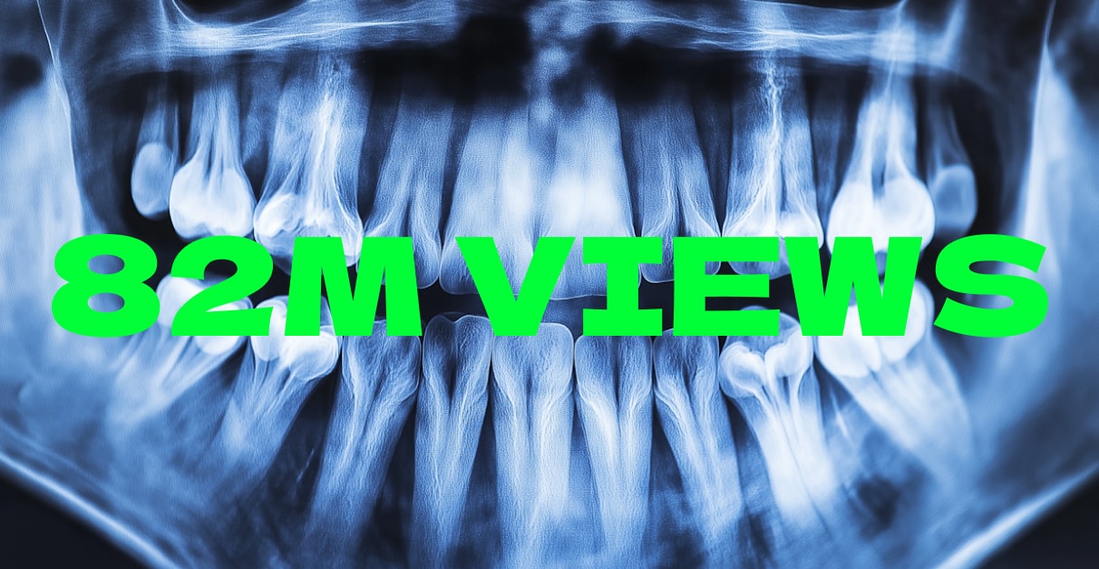 Purple To White Teeth in 10 Seconds: 82M Views